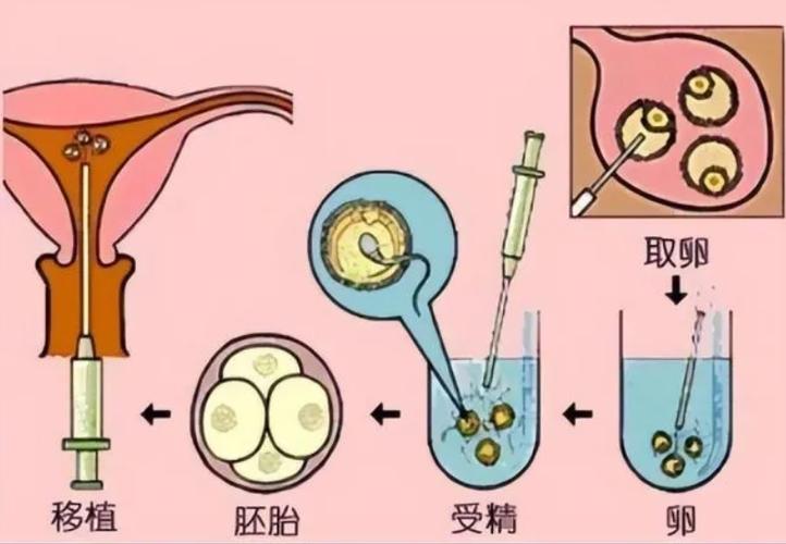 武汉三代供卵试管婴儿(武汉三代供卵试管婴儿:医学与伦理的交汇)