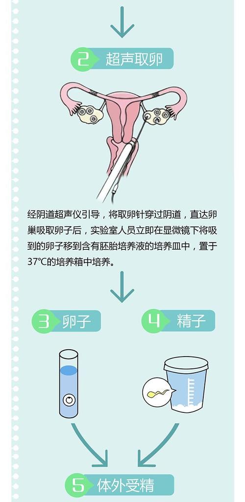 广州三代供卵试管流程(广州三代供卵试管流程解析)
